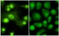 Anti-Thyroid Hormone Receptor ß1 (THRB1) (RABBIT) Antibody