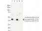 Anti-Human RRM2B/p53R2 (RABBIT) Antibody