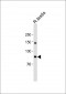 PIWIL1 (PIWI) Antibody (N-term)