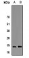 Anti-FABP6 Antibody