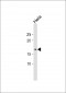 POLE3 Antibody (N-term)