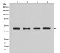 beta Actin Antibody