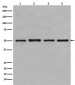 beta Tubulin Antibody