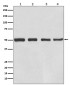 beta III Tubulin Antibody