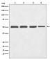 beta III Tubulin Antibody