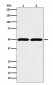 beta Tubulin Antibody