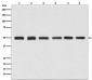 beta Tubulin Antibody (HRP conjugated)