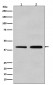 alpha smooth muscle Actin Antibody