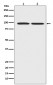 beta Catenin Antibody 