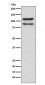 delta 1 Catenin/p120 Catenin Antibody