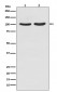 Androgen Receptor Antibody