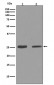 Cleaved PARP Antibody