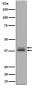 Phospho-Erk1 (T202/Y204) + Erk2 (T185/Y187) Antibody