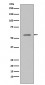 Phospho-p53 (S33) Antibody