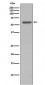 Phospho-Vimentin (S72) Antibody