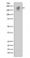 VEGF Receptor 1 Antibody