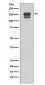 Integrin beta 1 Antibody