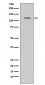 TERT Antibody