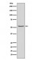 Phospho-Smad3 (S423 + S425) Antibody