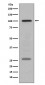 PMEL17 / GP100 Antibody