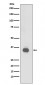 CD20 Antibody