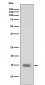 Phospho-Histone H3 (S10) Antibody