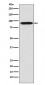 Bcl-6 Antibody