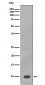 S100B Antibody