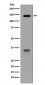 LDL Receptor Antibody 