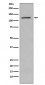 Phospho-Retinoblastoma (S780) Antibody