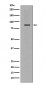 Cleaved PARP Antibody