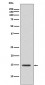 Histone H3 (acetyl K14) Antibody