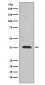 Synaptophysin Antibody 