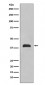 TTF1 Antibody