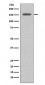 DAP Kinase 1 Antibody