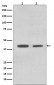 ACADM Antibody