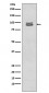 Phospho-STAT3 (S727) Antibody