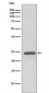 RAB11A Antibody