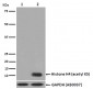 Histone H4 (acetyl K5) Antibody