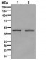 Glutamine Synthetase Antibody  