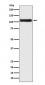 Androgen Receptor Antibody