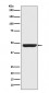 Cytokeratin 20 Antibody