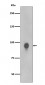 Phospho-RSK1 p90 (T359+S363) Antibody