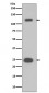 PARP Antibody