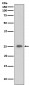 C Reactive Protein Antibody