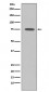 Somatostatin Receptor 2 Antibody