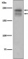 VEGF Receptor 2 Antibody