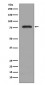 PKC beta 2 Antibody 