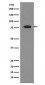 Transferrin Antibody 