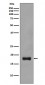 Stathmin 1 Antibody